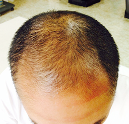 After