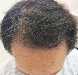 After